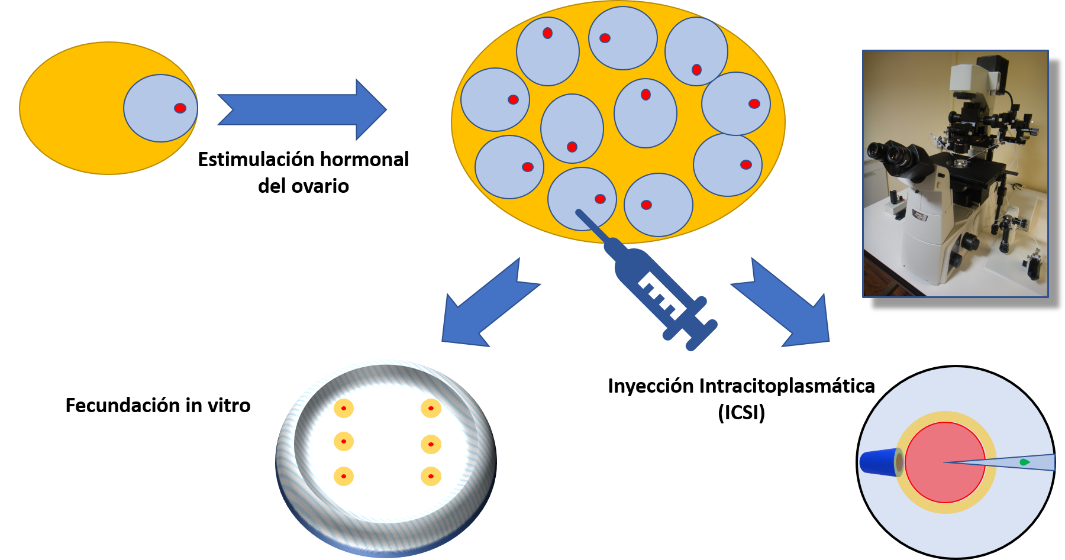 lustración 1. Para la realización de ciclos de FIV/ICSI es necesario "hiperestimular" el ovario para conseguir múltiples folículos ovulatorios (en lugar de uno sólo). Mediante punción de estos folículos obtendremos múltiples cúmulus oophorus que contendrán su óvulo.
