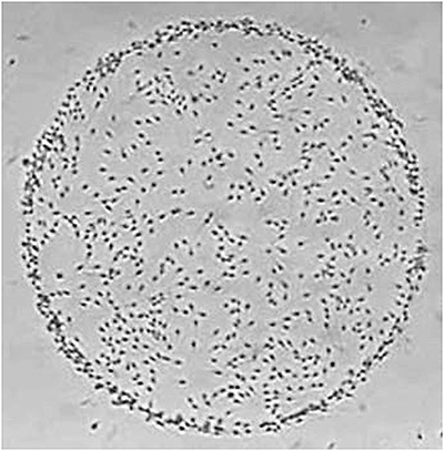 Ilustración 3  El círculo está formado por los espermatozoides adheridos al Ácido Hialurónico en la técnica de PICSI ó ICSI fisiológica .