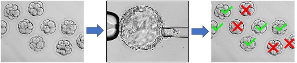 Ilustración 4 El diagnóstico preimplantacional permite seleccionar embriones sanos antes del proceso de transferencia al útero materno.