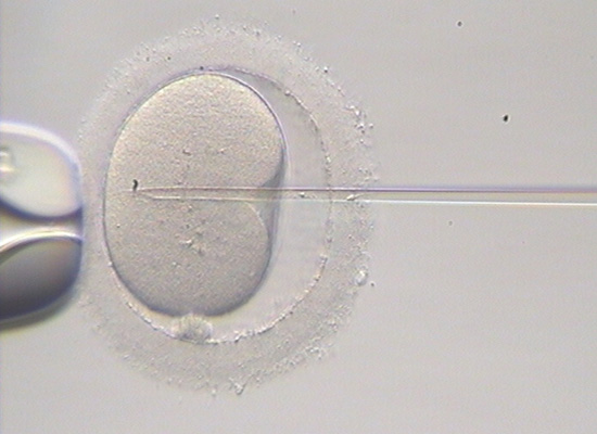 Fecundacion in vitro en Ciudad Real