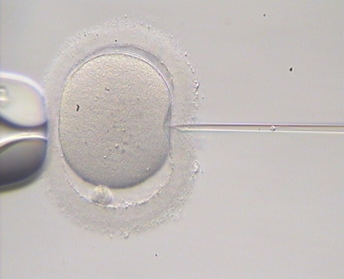 Tratamiento de fertilidad en Ciudad Real