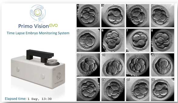 Ilustración 2. En Ginequalitas Reproducción los equipos Primo Vision Evo® nos permiten seguir el desarrollo de los embriones en el entorno más seguro, dentro del incubador, sin perturbar el desarrollo embrionario con movimientos o manejo innecesario fuera del incubador.