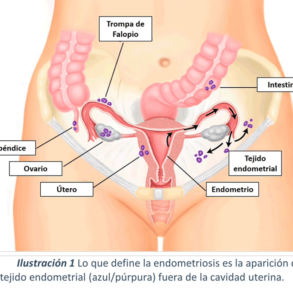 Problemas en el embarazo