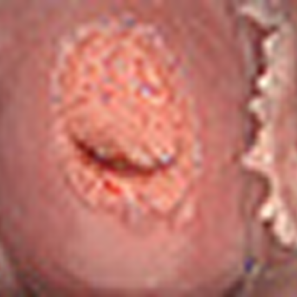 Dolores menstruales